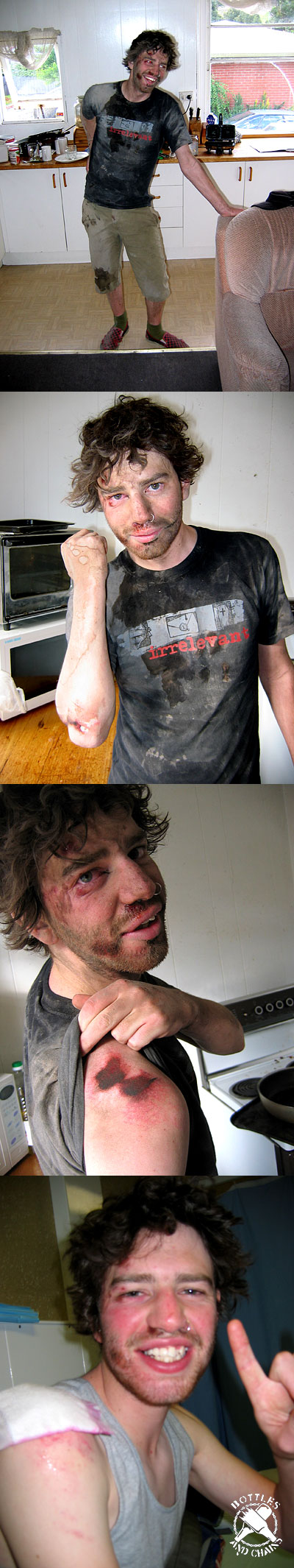 Dicko’s Pain Montage